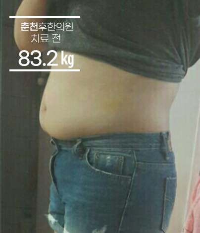 치료 전