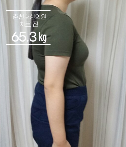 치료 전