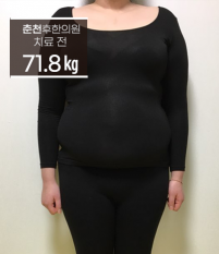 치료 전