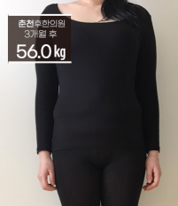 치료 후