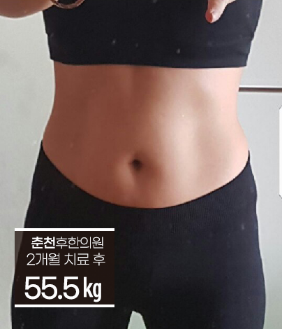 치료 후