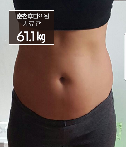 치료 전