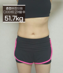 치료 후