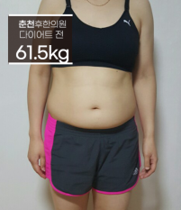 치료 전
