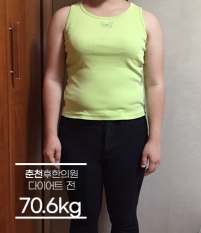 치료 전