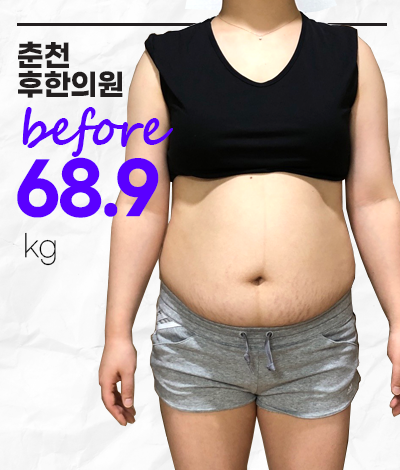 치료 전