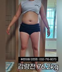 치료 전