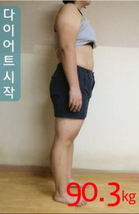치료 전