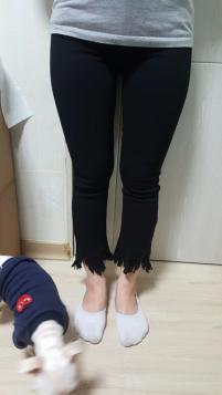 치료 전