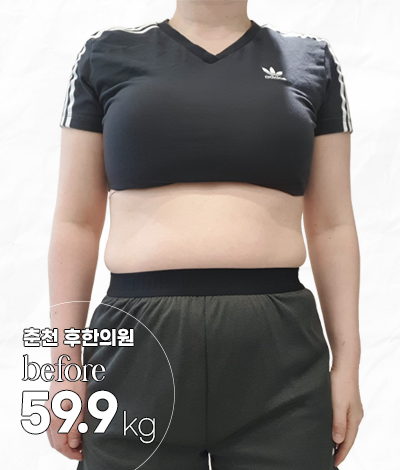 치료 전