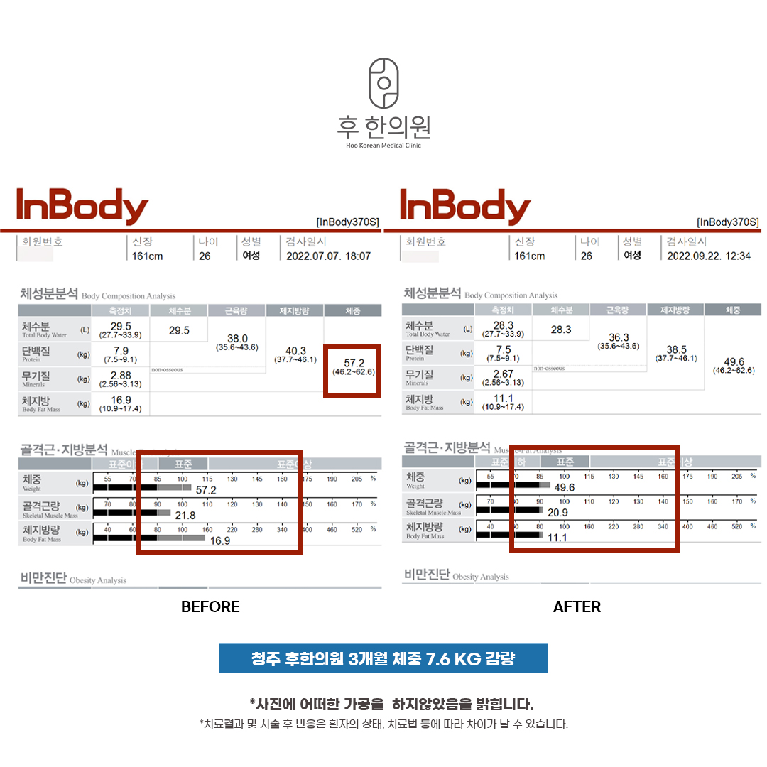 치료 후