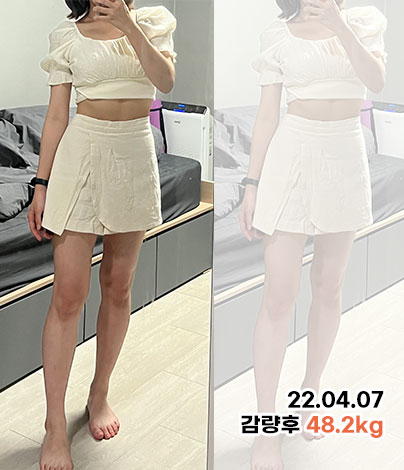 치료 후