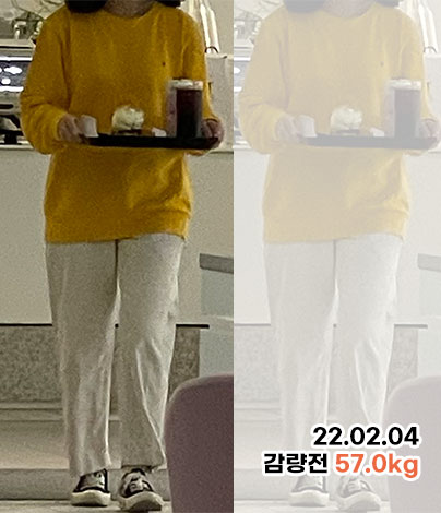 치료 전