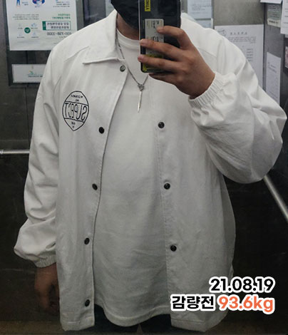 치료 전