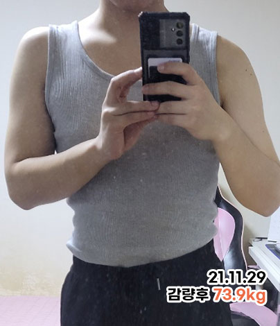 치료 후