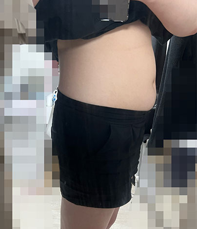 치료 전