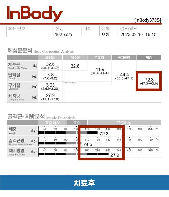 치료 후