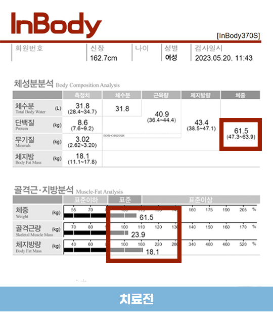 치료 전