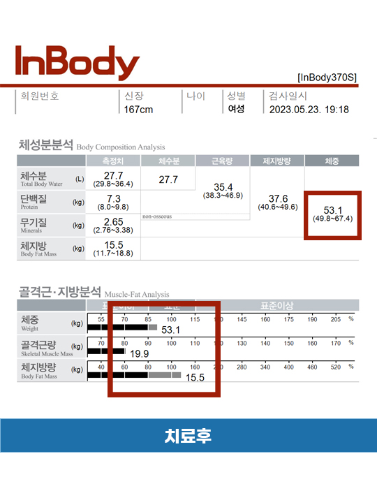 치료 후