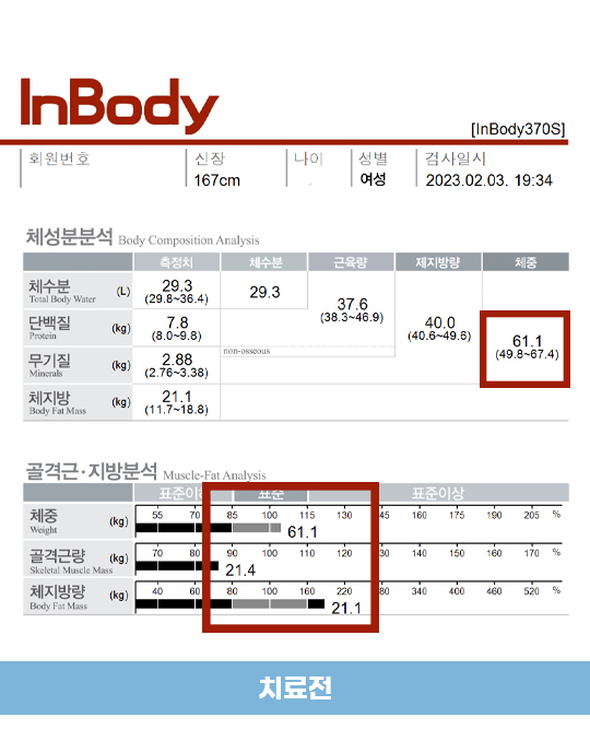 치료 전