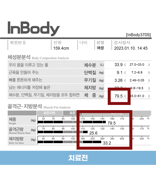 치료 전
