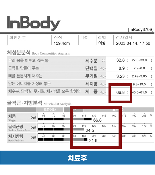 치료 후