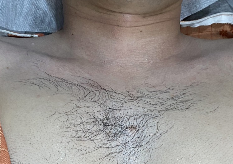 치료 후