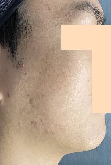 전후사진
