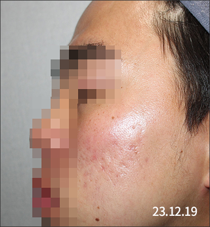 전후사진