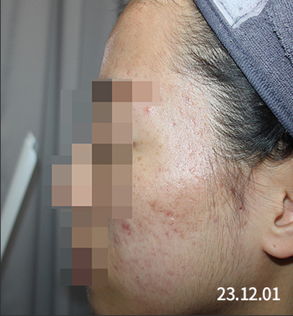 전후사진