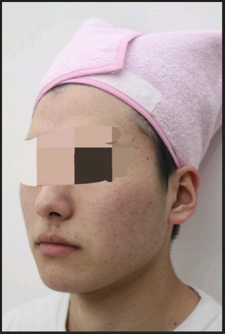 전후사진