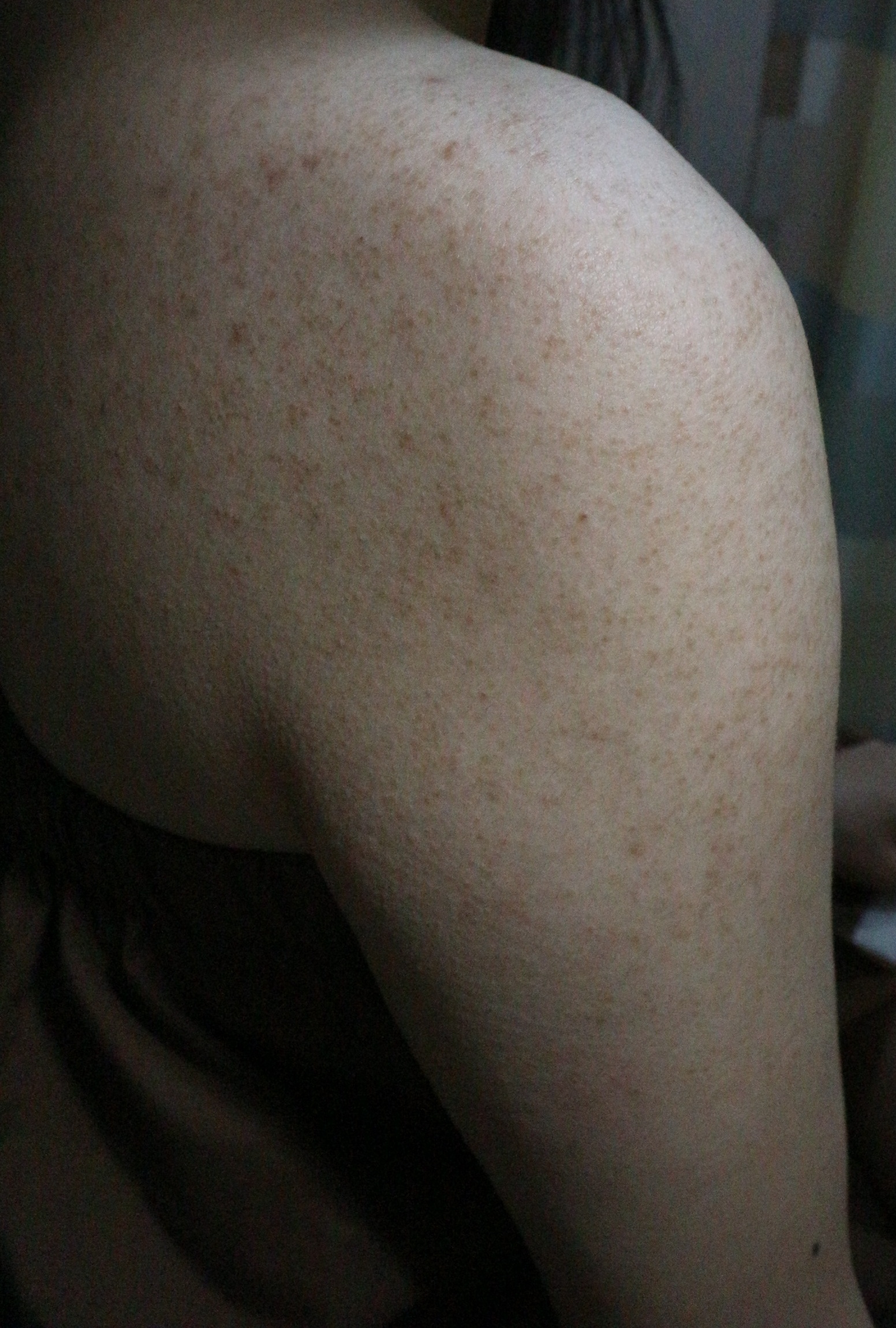 전후사진