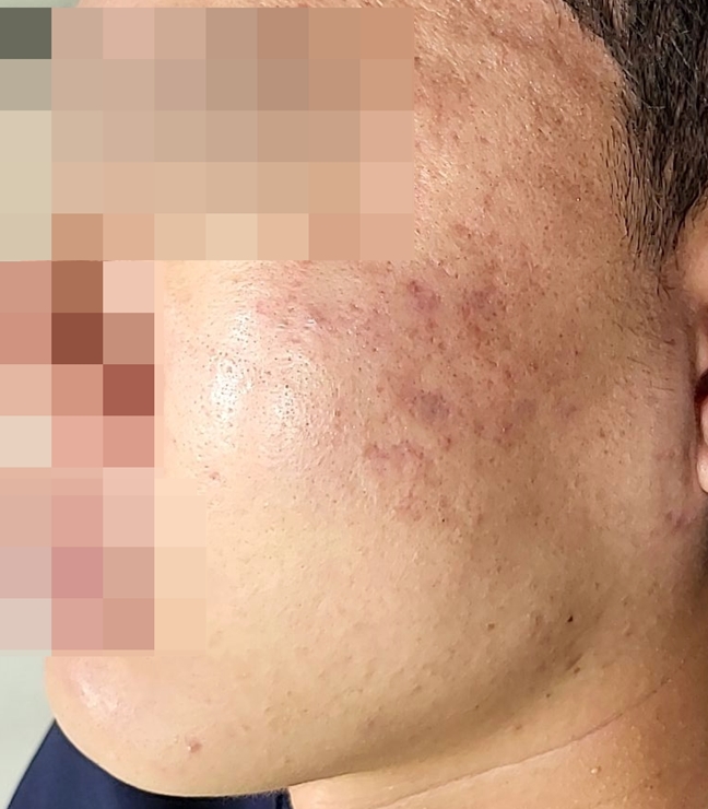 전후사진