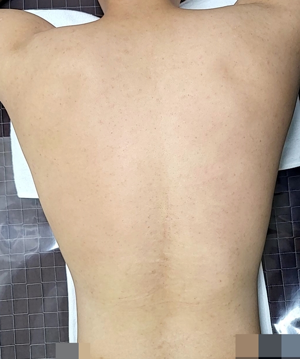 치료 후