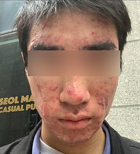 전후사진