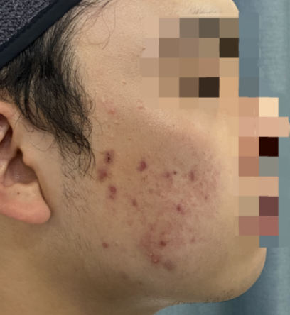 전후사진