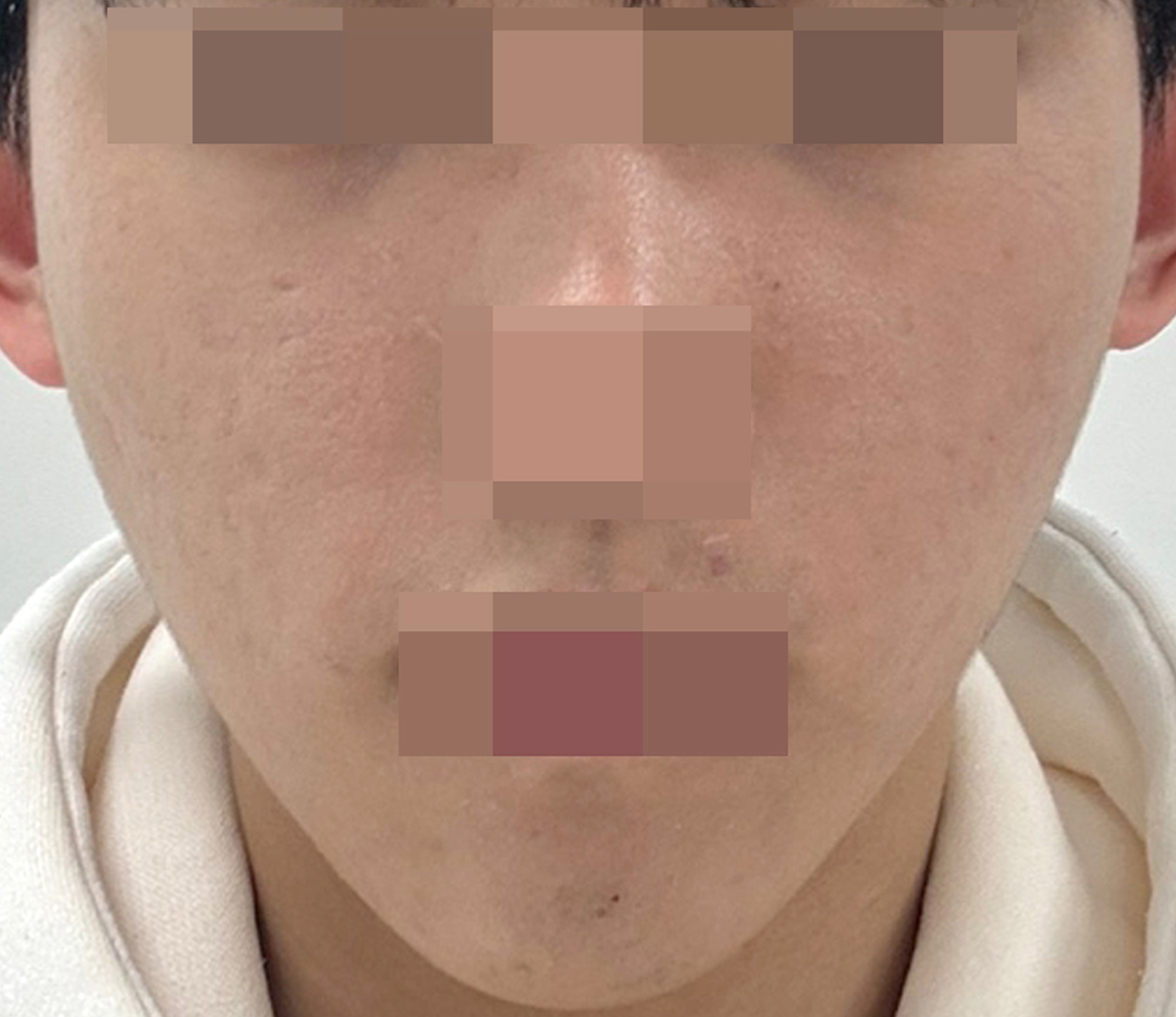 치료 후