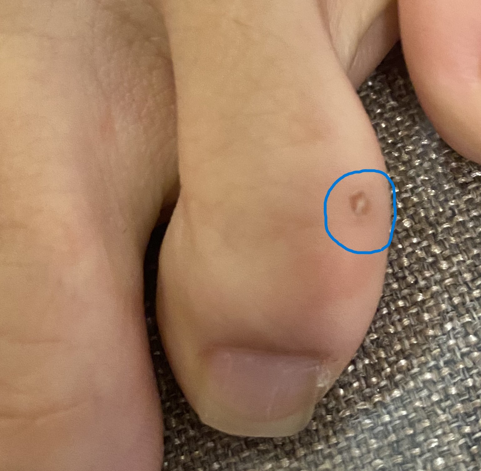 전후사진