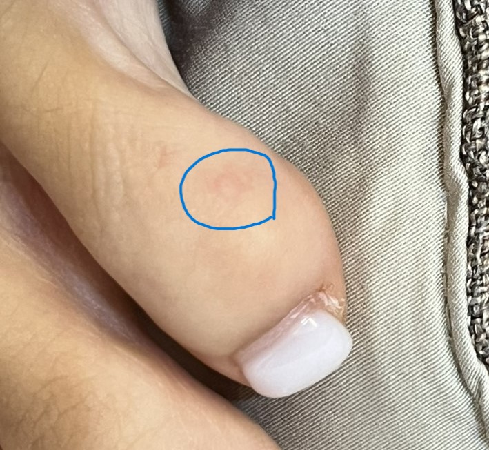 전후사진