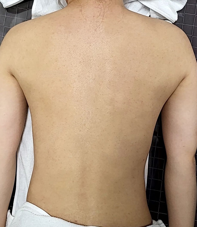 전후사진