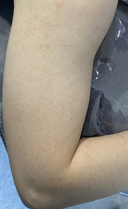 전후사진