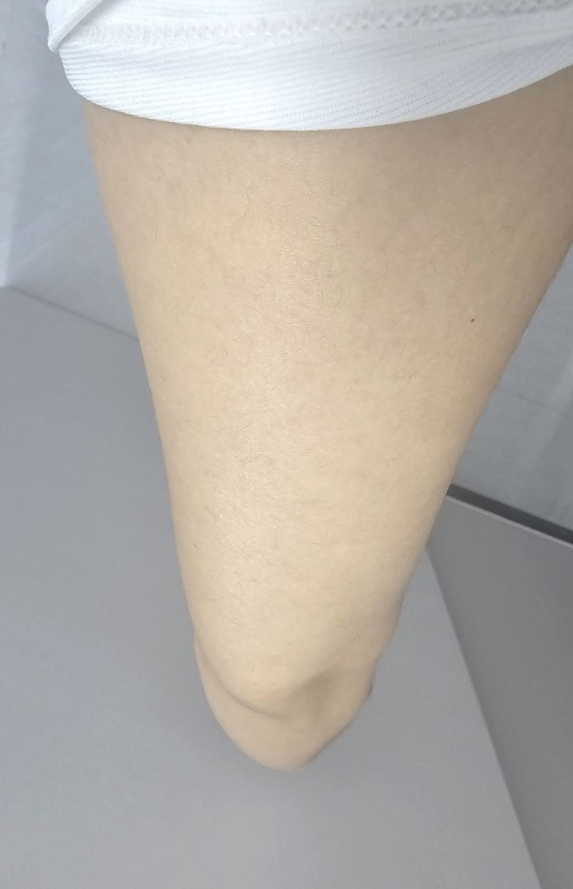 전후사진
