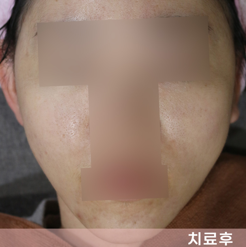 전후사진