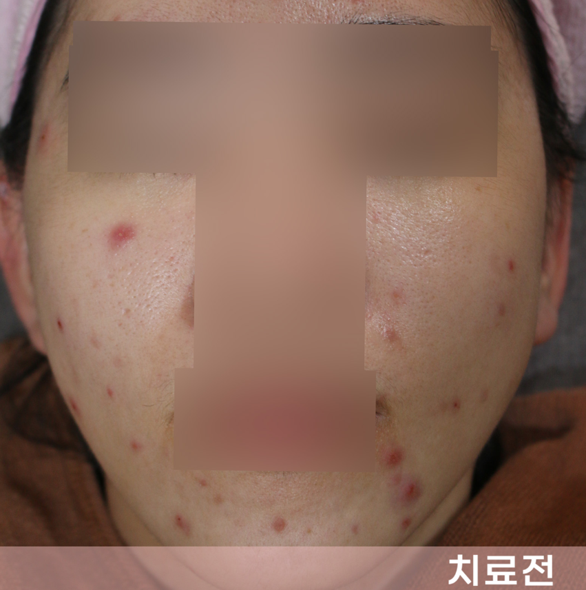 전후사진