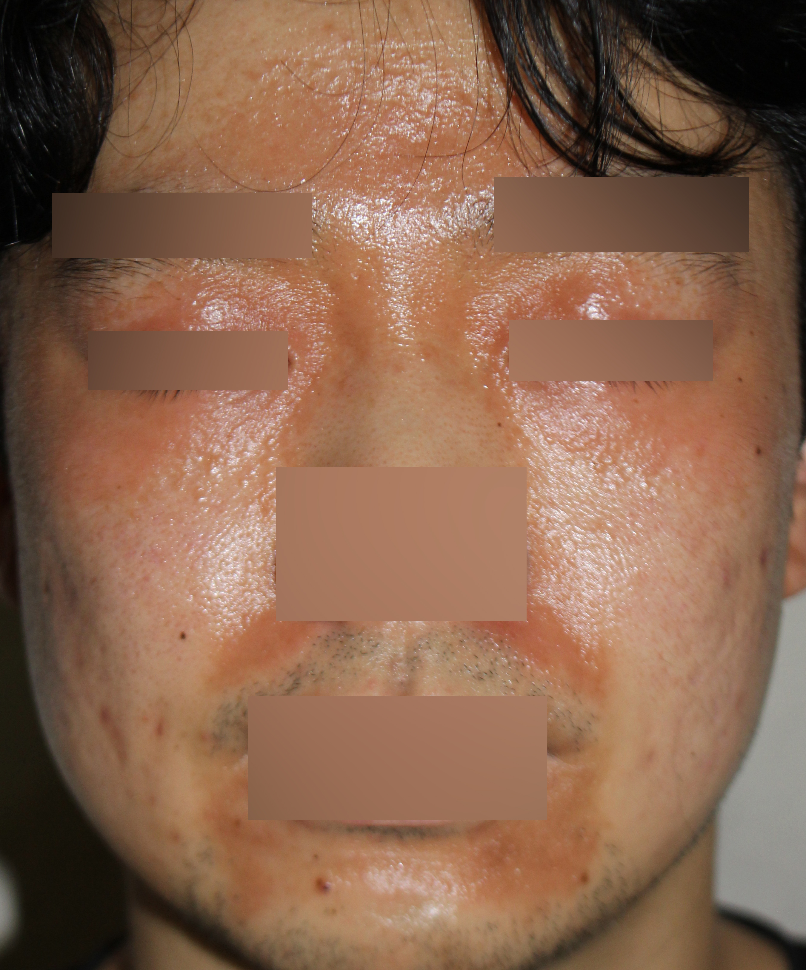 전후사진
