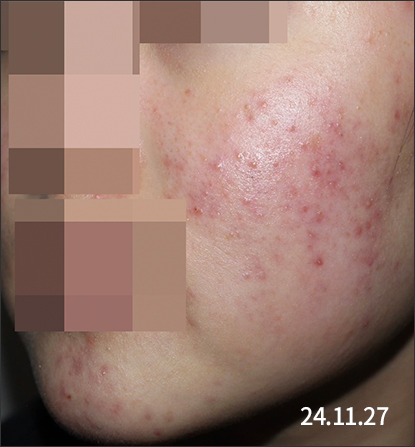 전후사진