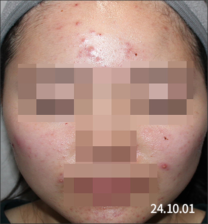 전후사진