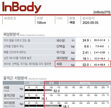 전후사진