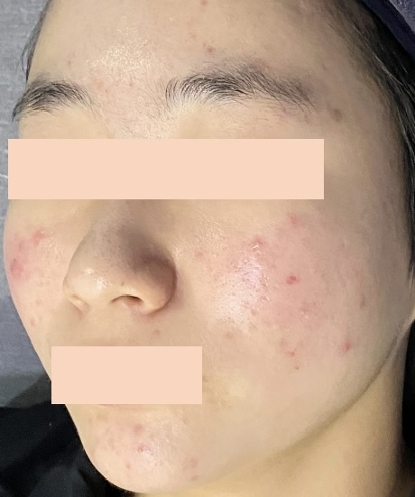 전후사진