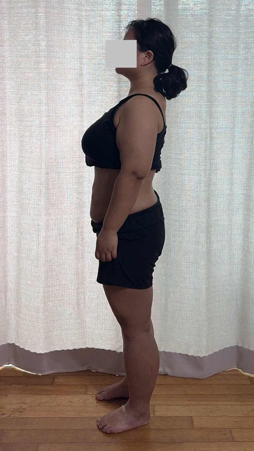 천안점 치료 후
